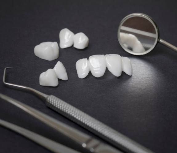 Several white dental crowns and veneers on table with dental mirrors