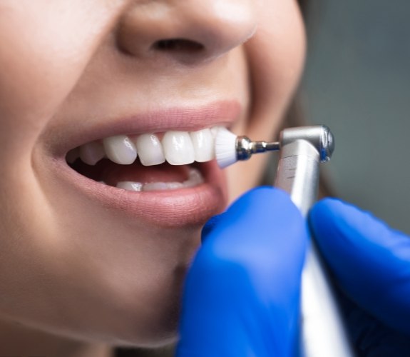 Close up of a person receiving a dental cleaning