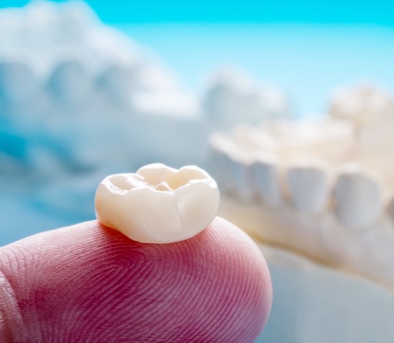 Dental crown resting on a finger