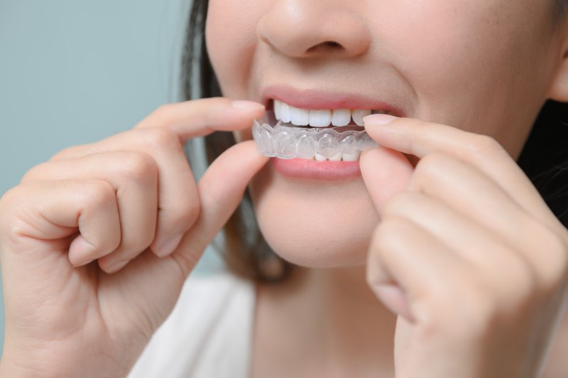 woman preparing to insert clear retainer